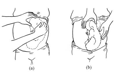 (a) baby is head down. (b) baby is breech