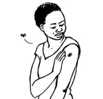 A woman is looking at her arm. She has been bitten by a mosquito which is flying away.