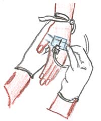 The figure shows the cannula inserted into the hand being held in place by a plaster.
