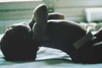 A baby with rigidity and arching of the whole body.