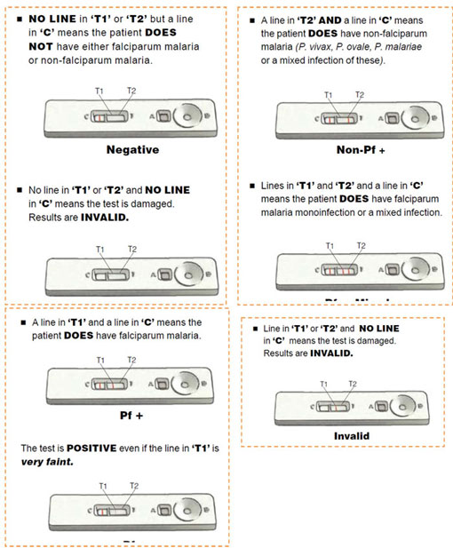 The different possible test results of a malaria RDT.