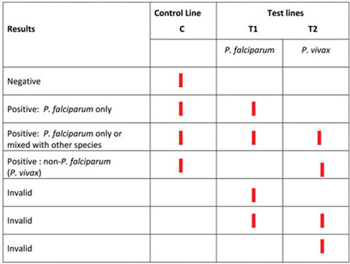 Malaria RDT interpretation chart.