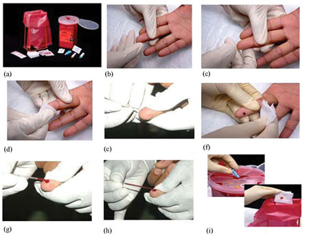 The procedure used to take a sample of blood for HIV testing.