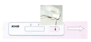A sample of blood is placed in the sample port of a KHB test device, using the capillary tube.