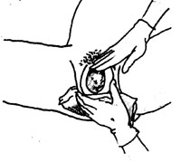 The baby's head emerges from the woman's vagina during birth.