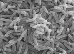 Vibrio cholerae bacteria magnified thousands of times