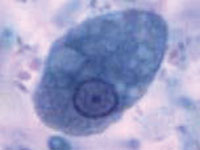 cd_session34_fig1