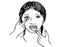 Paleness inside the eyelids and gums are signs of anaemia