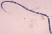 An Onchocerca volvulus worm