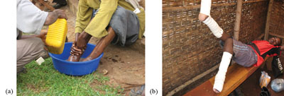 Washing feet and elevating the legs