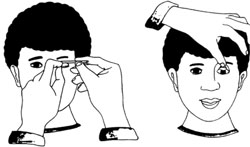 Examination of the conjunctiva