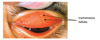 cd_session39_fig4.jpg