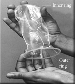 Female condom.