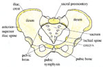 The pelvic inlet, viewed from above. Note the position of the ischial spines.