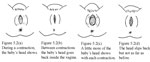 ldc_session5_fig2.jpg