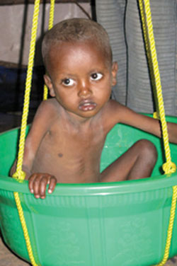 5  Improvised way of measuring weight of the child using salter scale