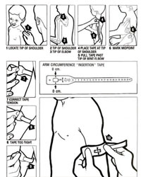 Measuring MUAC
